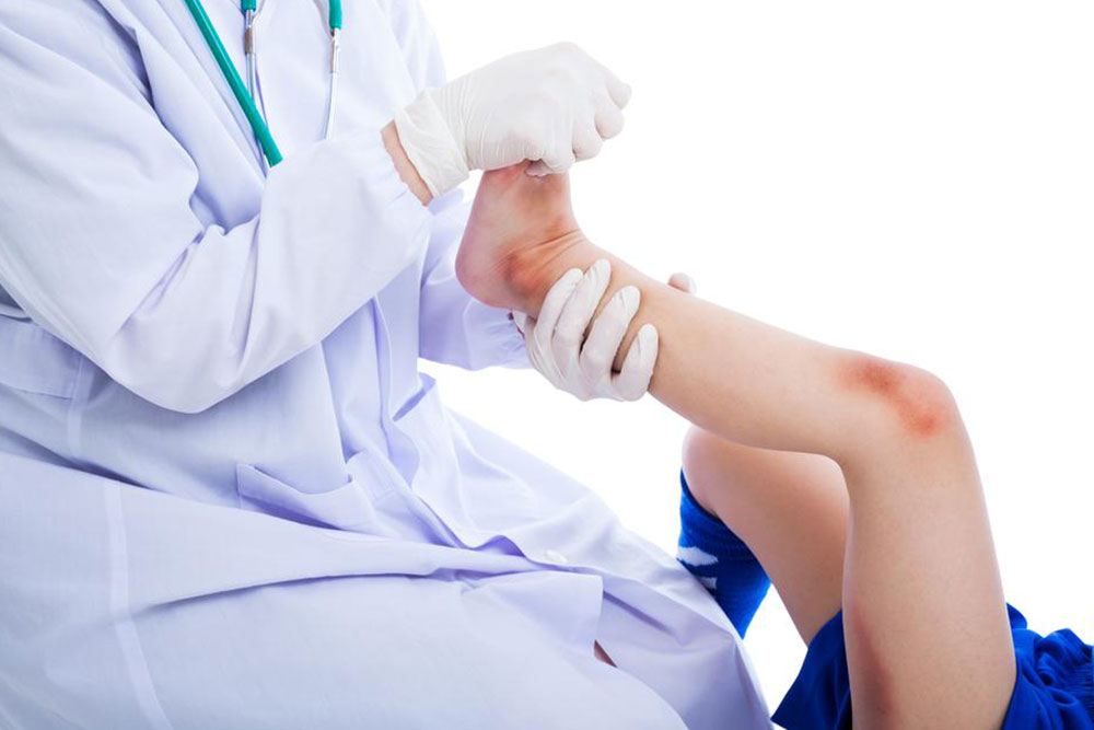 Effective Ways to Accelerate Bruise Healing Naturally