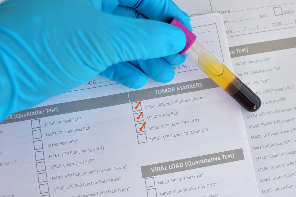 Understanding Age-Dependent PSA Levels and Their Significance