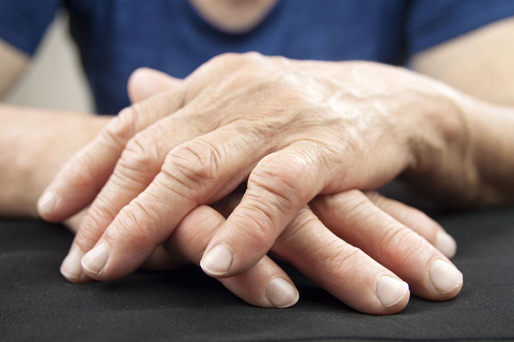 Understanding Rheumatoid Arthritis: Diagnosis and Management Strategies