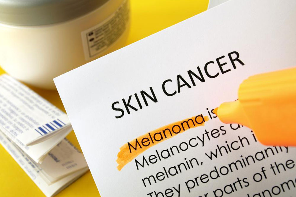 Comprehensive Guide to Skin Cancer: Causes, Signs, and Prevention
