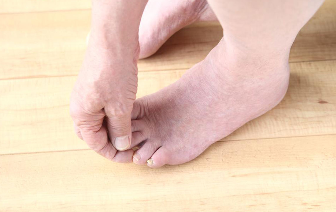 Understanding Common Causes of Foot Discomfort