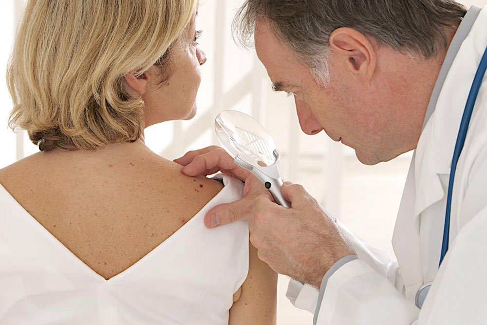 Treating Advanced Melanoma: Current Strategies and Advances