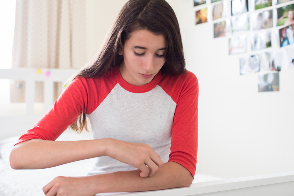Important Insights About Eczema You Should Know