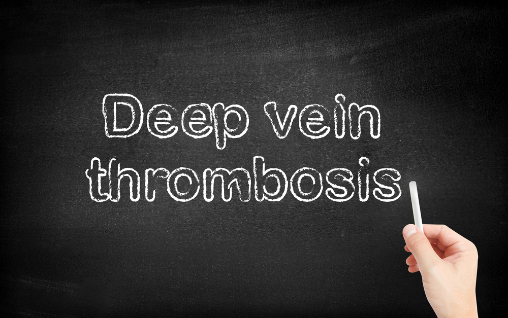 Comprehensive Strategies for Preventing Deep Vein Thrombosis (DVT) and Protecting Vascular Health