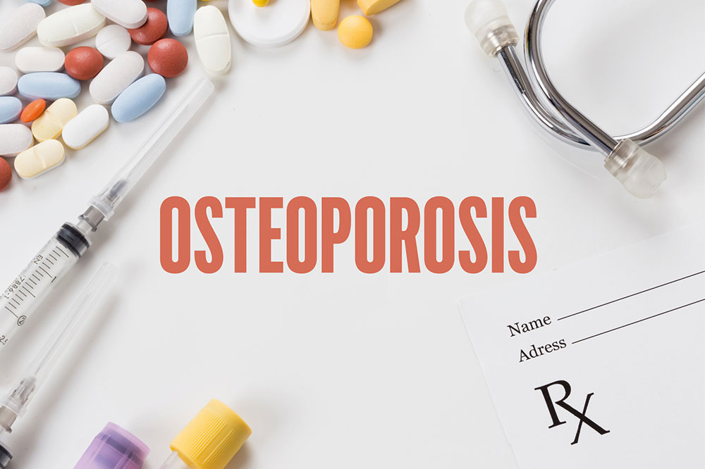 Comprehensive Guide to Osteoporosis Treatment Options