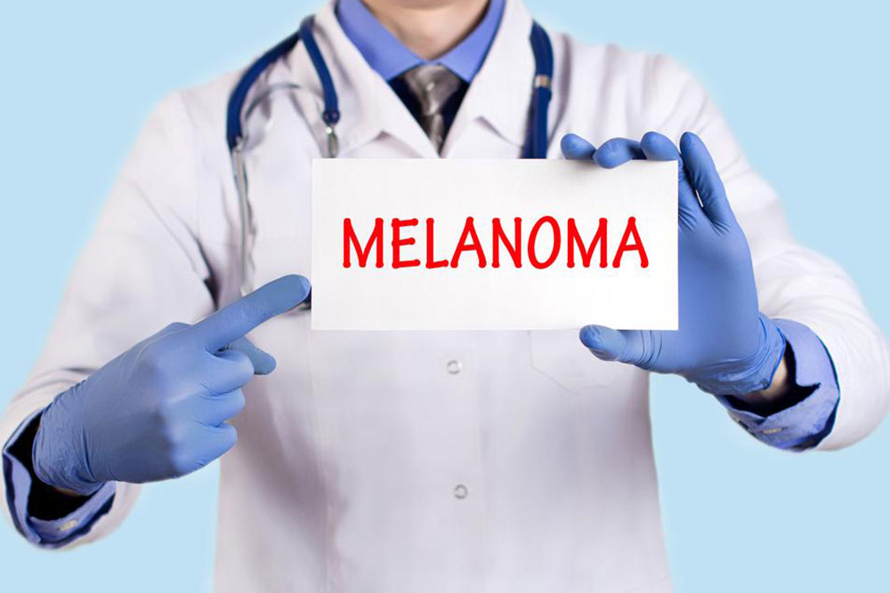 Early Detection and Treatment of Advanced Melanoma