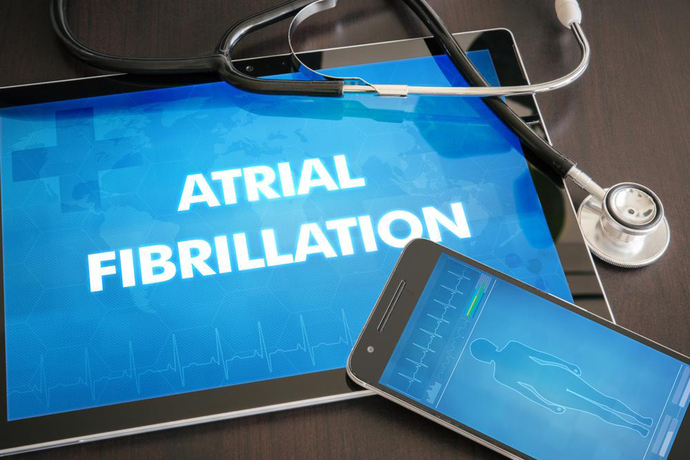 Recognizing and Managing Atrial Fibrillation Symptoms