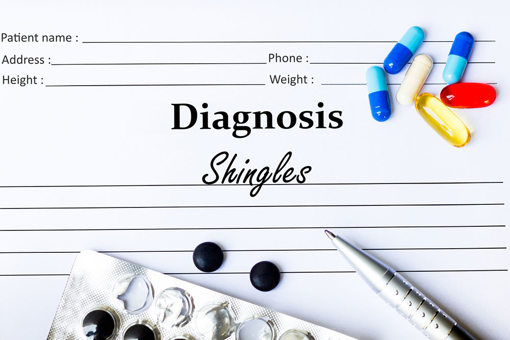 Understanding Shingles: Symptoms, Causes, and Treatment Strategies
