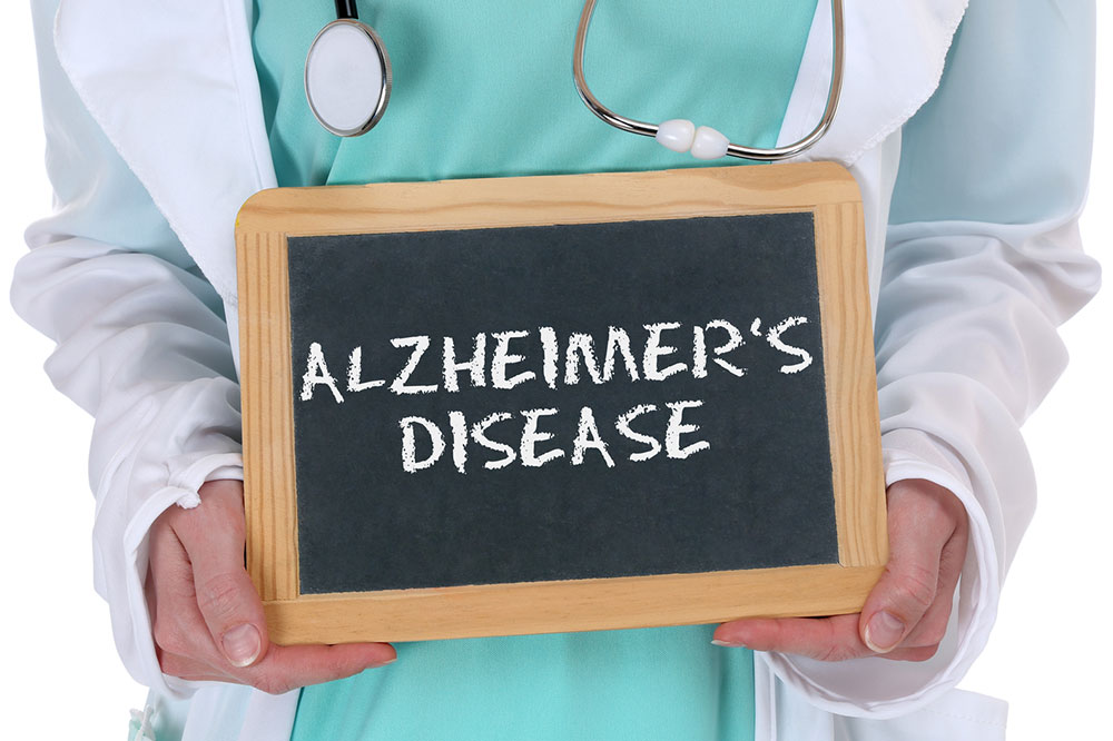 Essential Insights About Alzheimer’s Disease