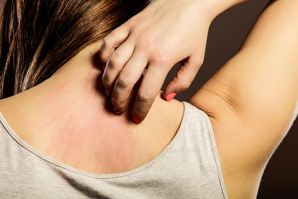 Effective Strategies to Alleviate Post-Shingles Discomfort