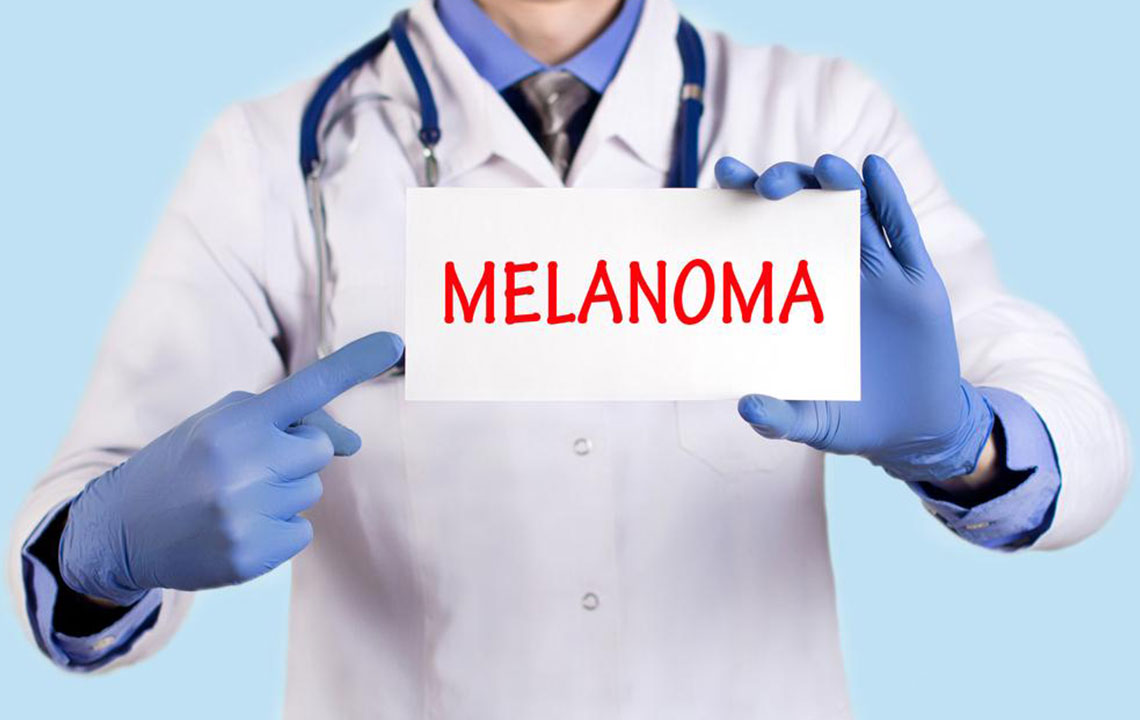 Understanding Metastatic Melanoma: Diagnosis and Treatment Strategies