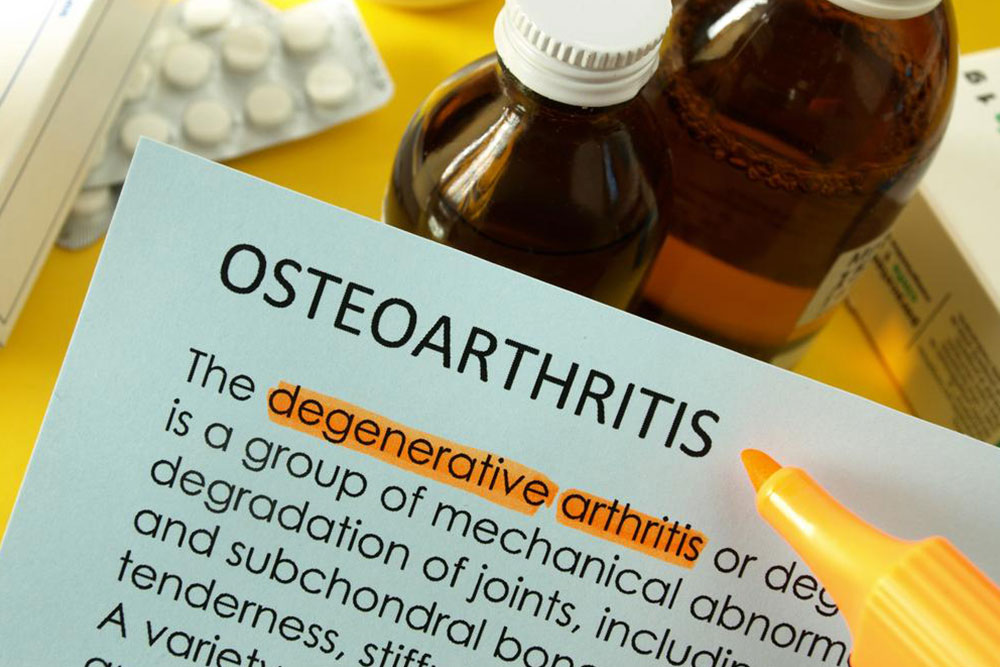 Effective Strategies for Managing and Treating Osteoarthritis