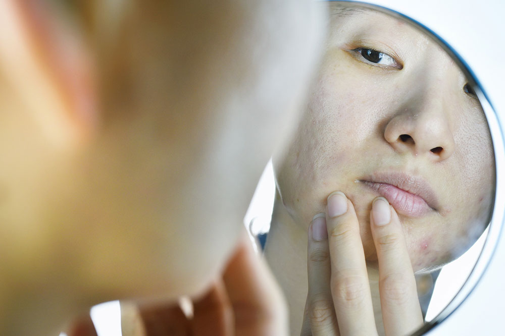 Comprehensive Guide to Common Skin Conditions: Causes, Symptoms, and Treatments
