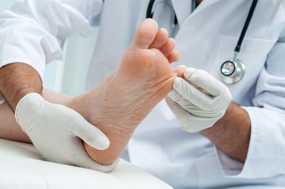 Effective Home Strategies for Managing Nail Psoriasis and Enhancing Nail Health