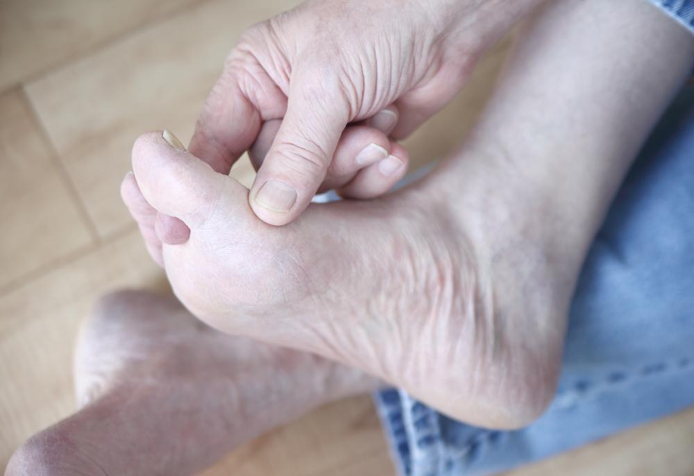 Top 5 Causes of Fungal Infections You Should Know
