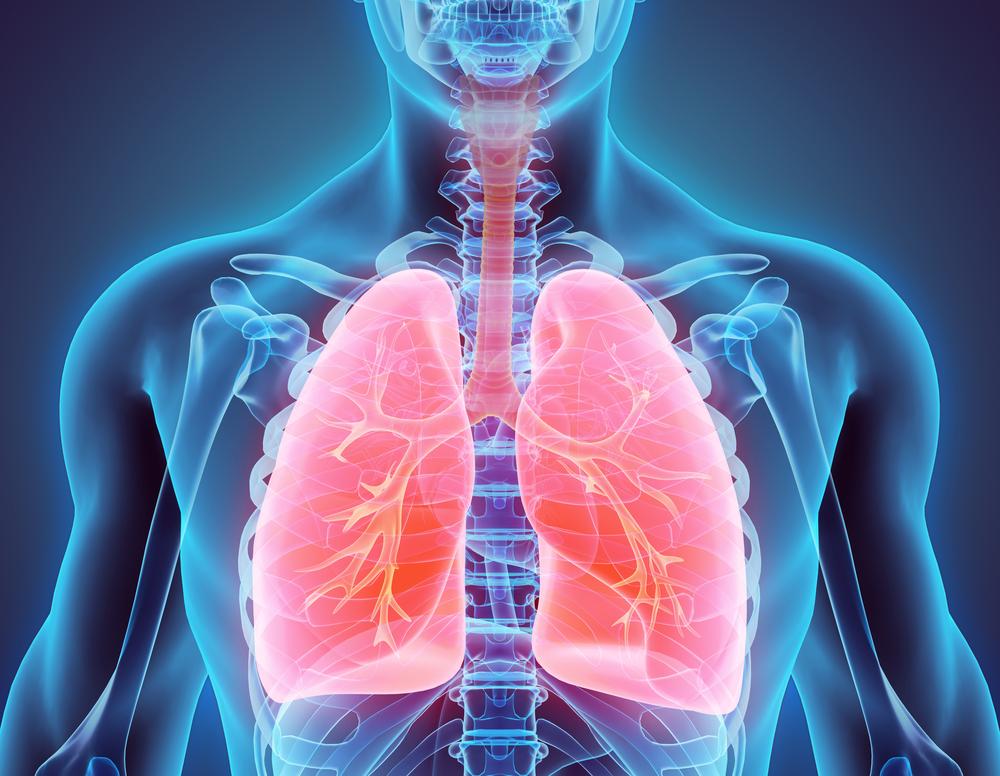 Effectiveness of Chemotherapy and Drugs in Lung Cancer Treatment