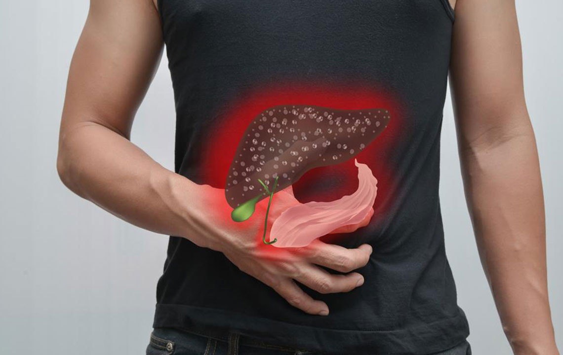 Understanding How Hepatitis C Impacts Liver Health