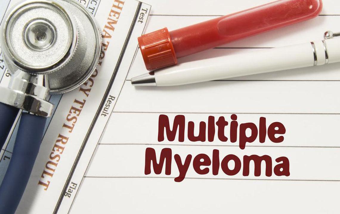 Comprehensive Guide to Multiple Myeloma: Types, Symptoms, and Advanced Treatment Options