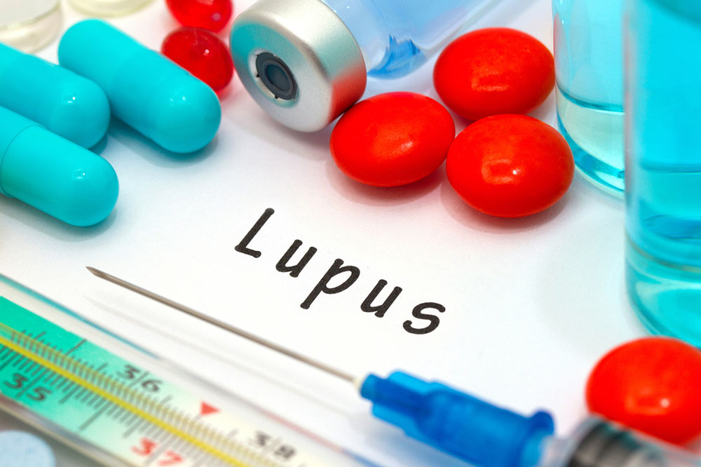 Recognizing the Top 7 Symptoms of Lupus