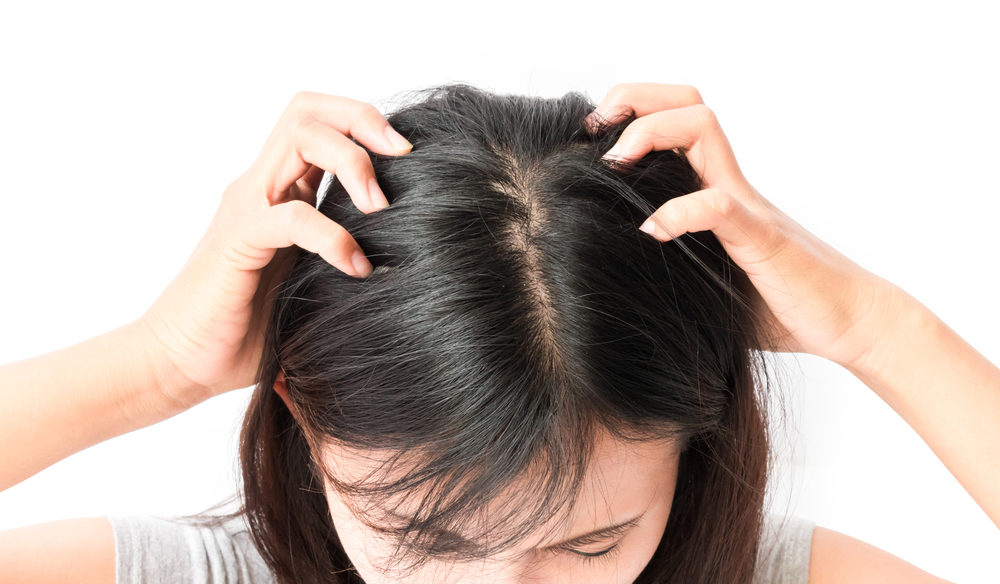 Essential Tips for Managing an Itchy Scalp