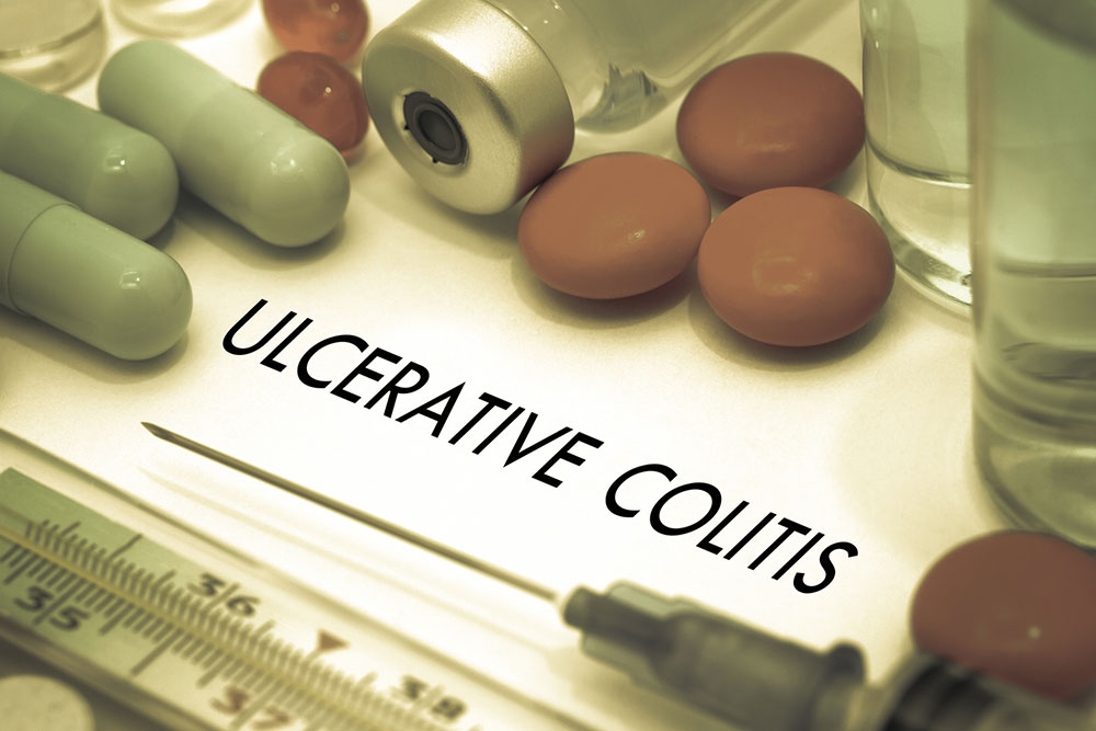Top 5 Causes of Colitis and How to Recognize Them