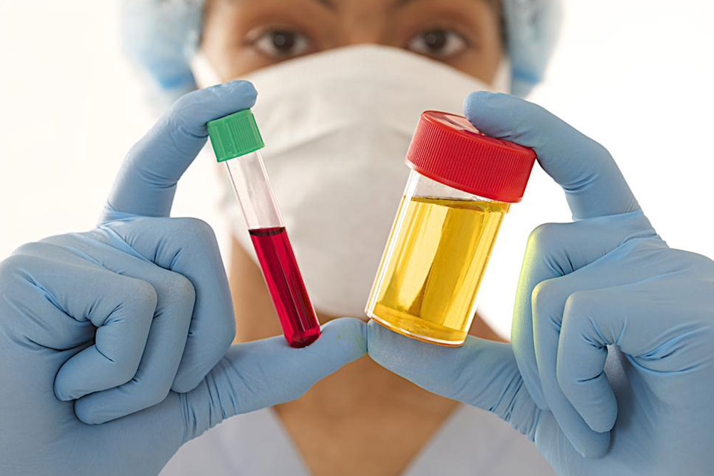 Understanding Common Causes of E. coli in Urine Infections