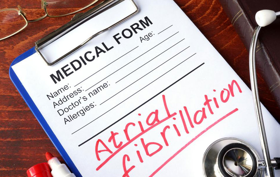 Understanding Atrial Fibrillation: Symptoms, Diagnosis, and Management