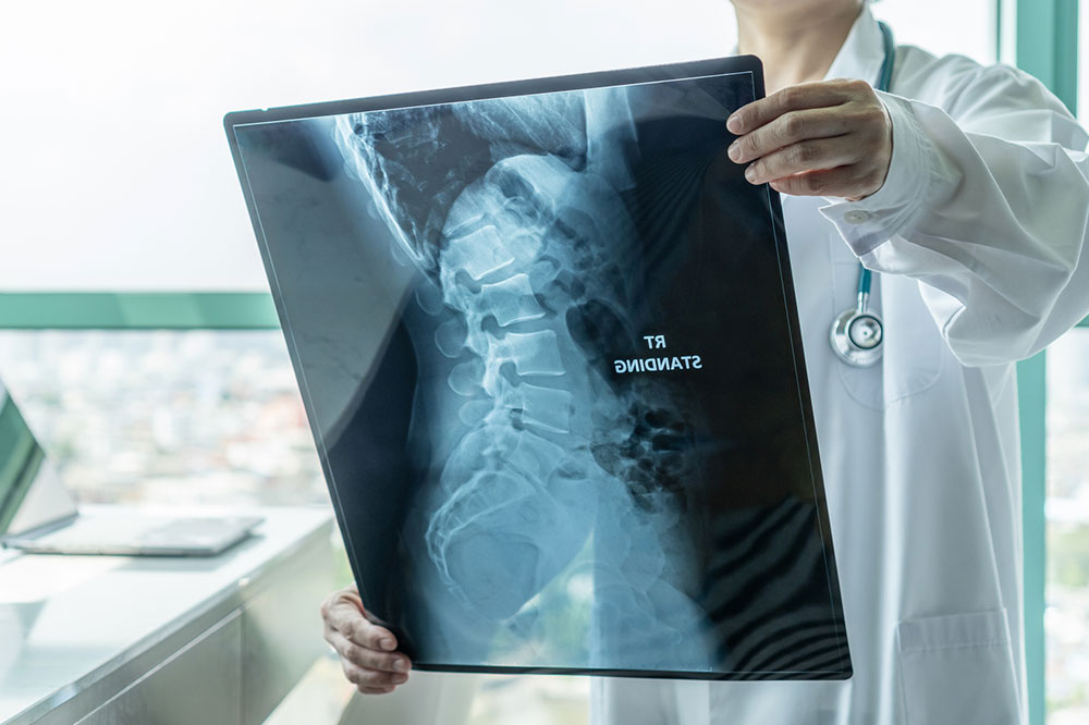 Understanding Spinal Muscular Atrophy: Types and Indicators