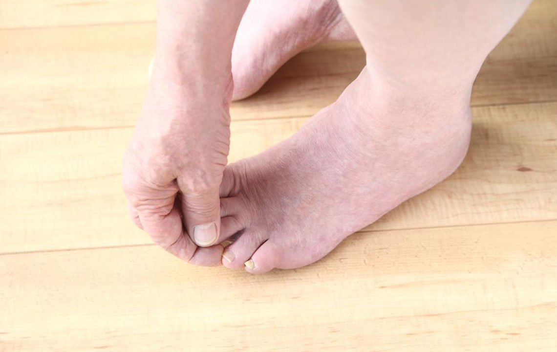 Understanding Foot Pain in Fibromyalgia: Key Insights
