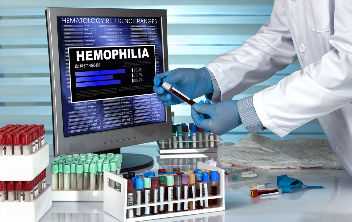 Understanding Hemophilia: Diagnosis and Outlook
