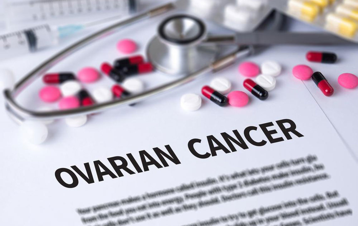 Essential Insights into Ovarian Cancer: Symptoms, Risks, and Treatments