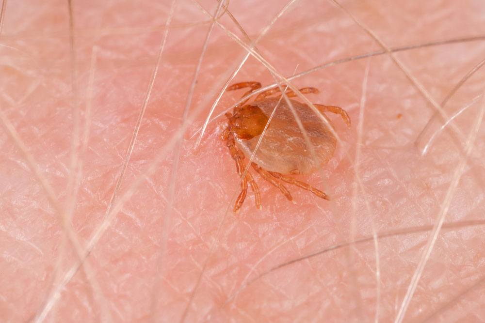 Effective Strategies for Managing Tick-Borne Diseases
