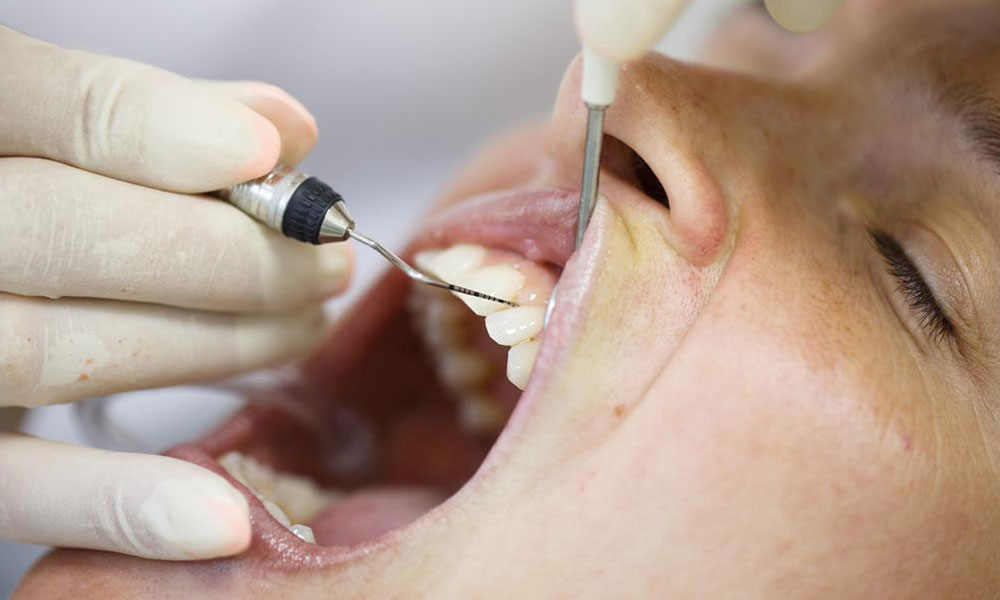 Identifying Risk Factors for Receding Gums