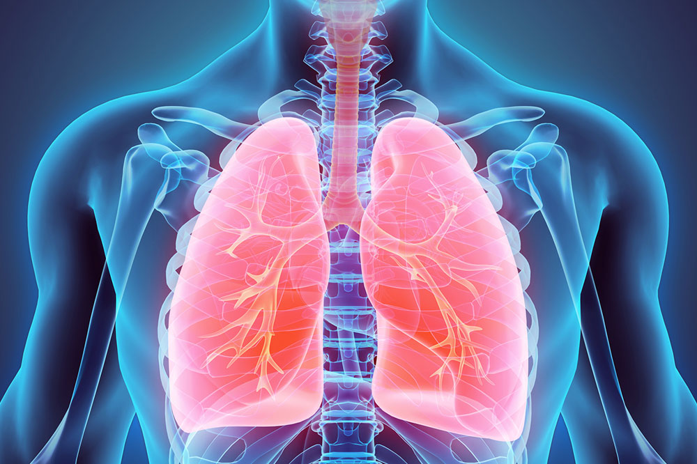 Comprehensive Guide to Understanding Lung Cancer