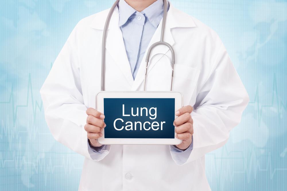 Innovative and Multidimensional Strategies for Lung Cancer Management