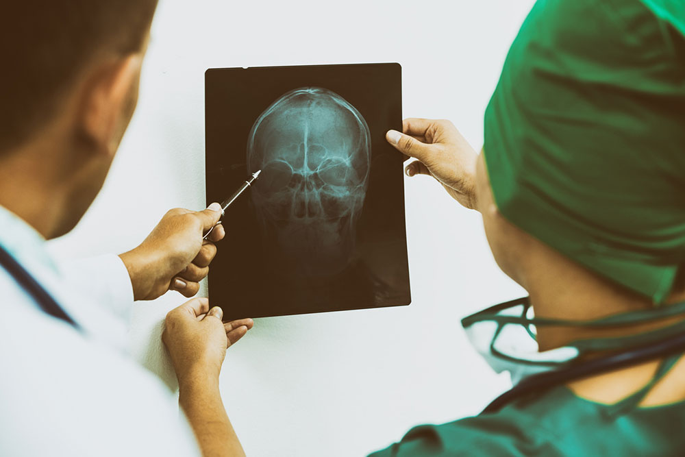 Top Strategies for Managing Schizophrenia Effectively
