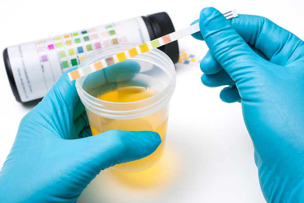 Deciphering Your Health Signs Through a Stool Color Guide