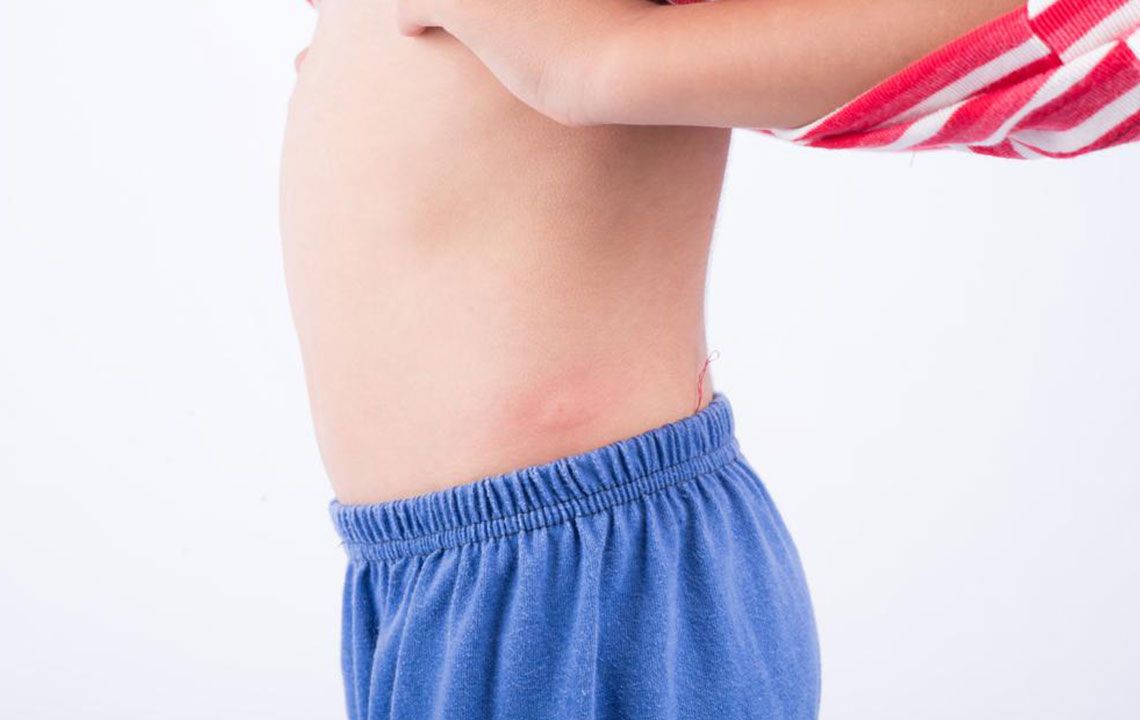 Comprehensive Guide to 10 Common Skin Rashes Every Person Should Know