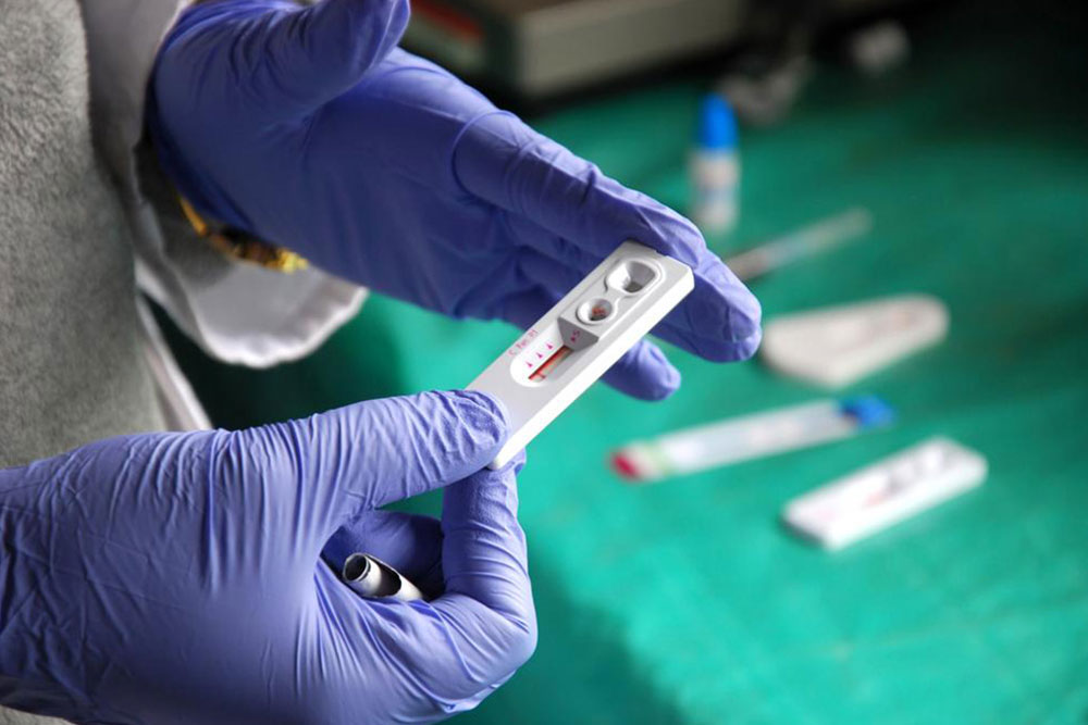 Understanding HIV: Symptoms and Management Strategies
