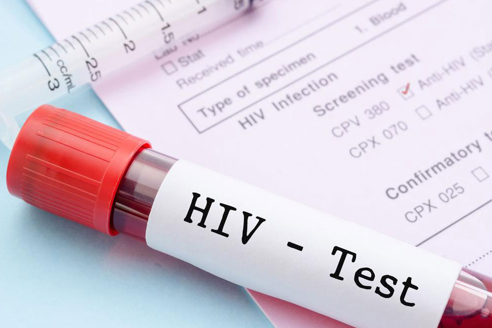 Early Indicators and Symptoms of HIV Infection