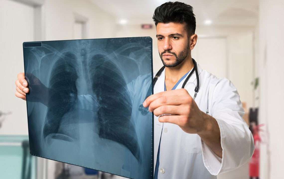 Recognizing the Key Signs of Pulmonary Embolism