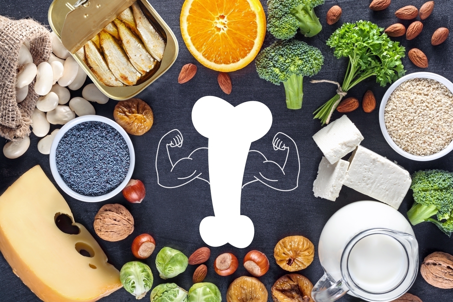 Nutritional Strategies for Stronger Bones and Better Bone Health