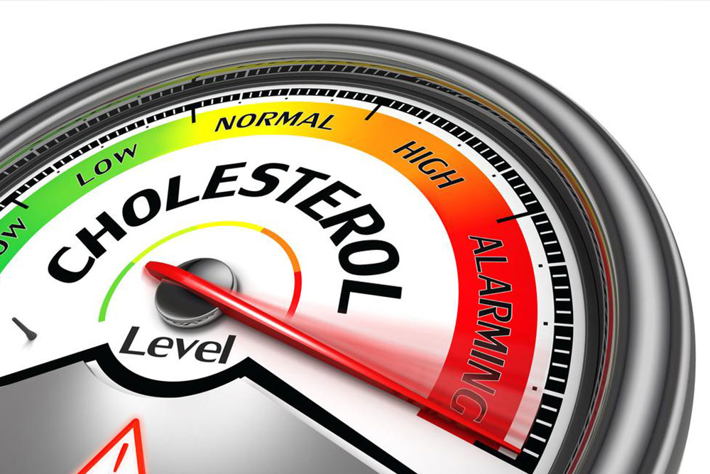 Understanding and Managing Elevated Cholesterol Levels