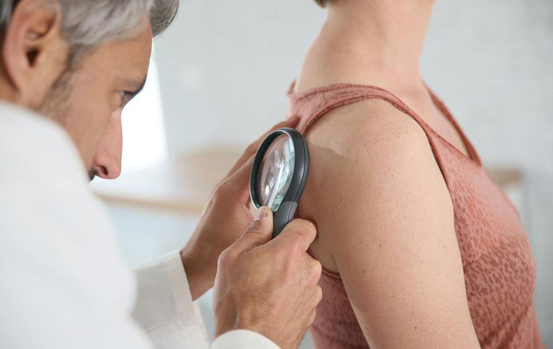 Effective Strategies to Heal from Shingles Quickly