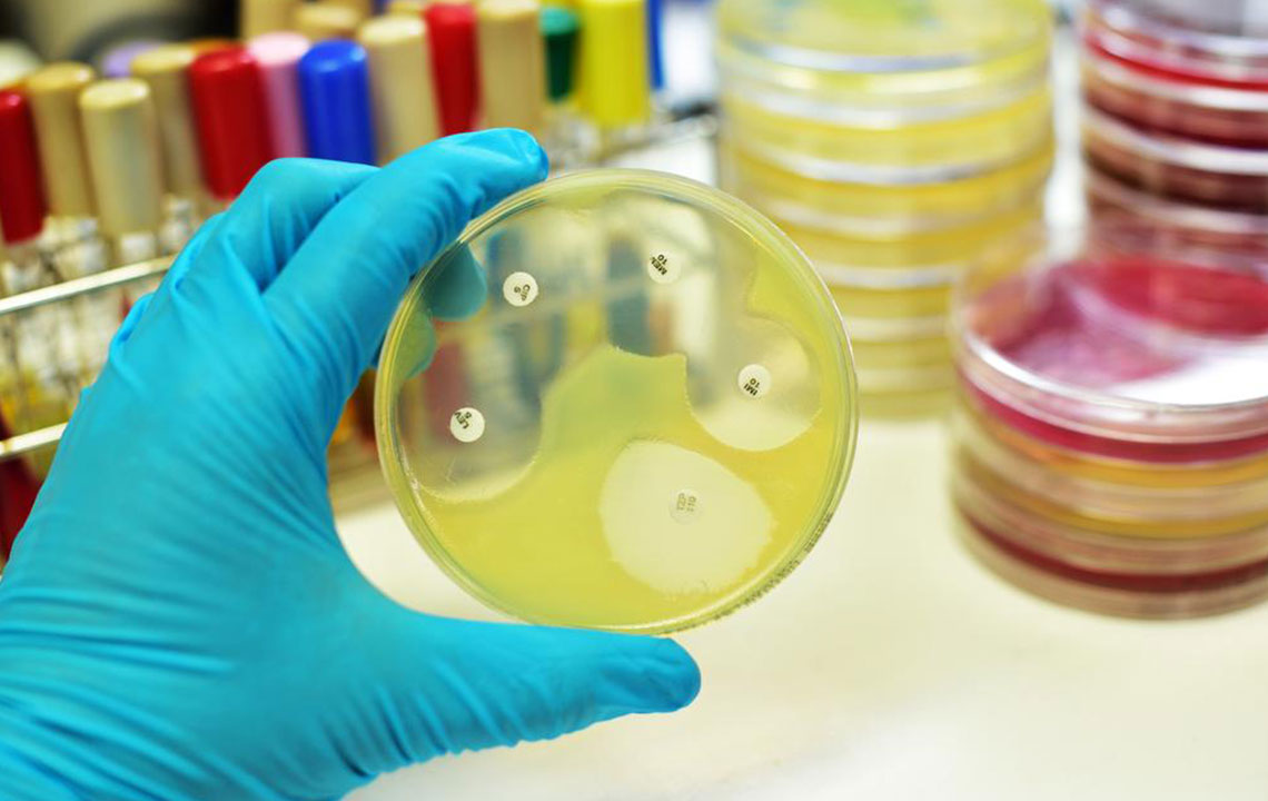 Understanding Meningitis: Types, Symptoms, and Prevention Strategies