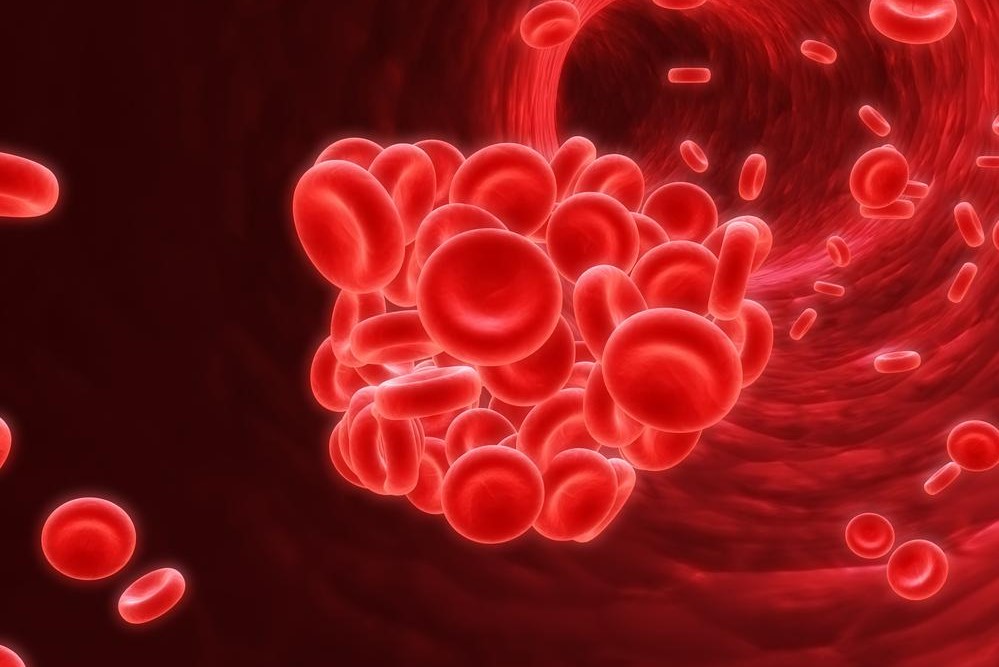 Comprehensive Guide to Blood Clots: Causes, Symptoms, and Effective Treatments