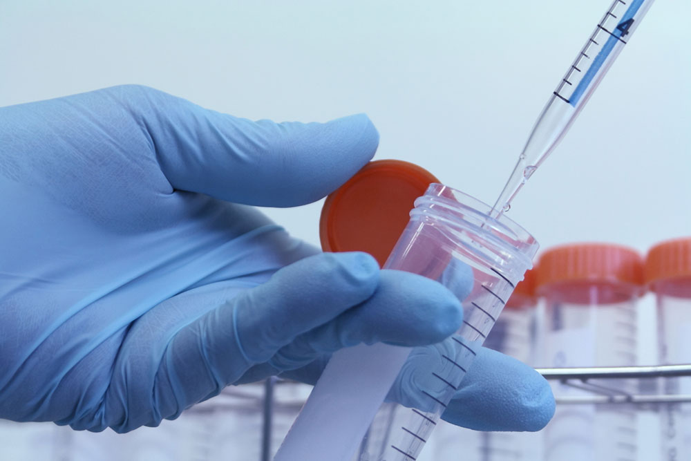 Essential Insights on Helicobacter Pylori Infections
