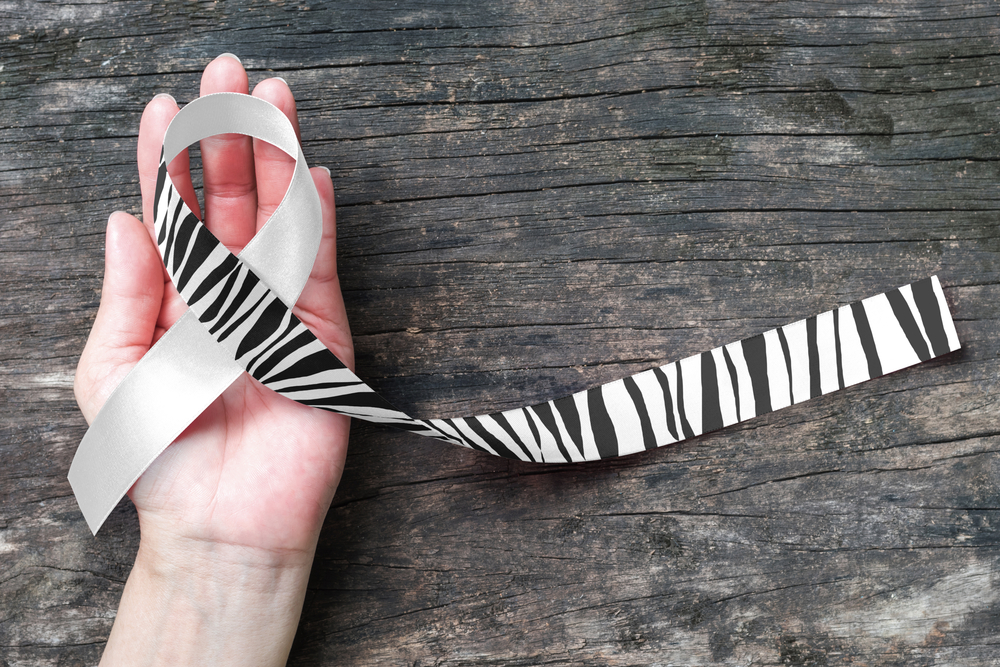 Comprehensive Guide to Carcinoid Neuroendocrine Tumors: Causes, Symptoms, Detection, and Prevention Strategies