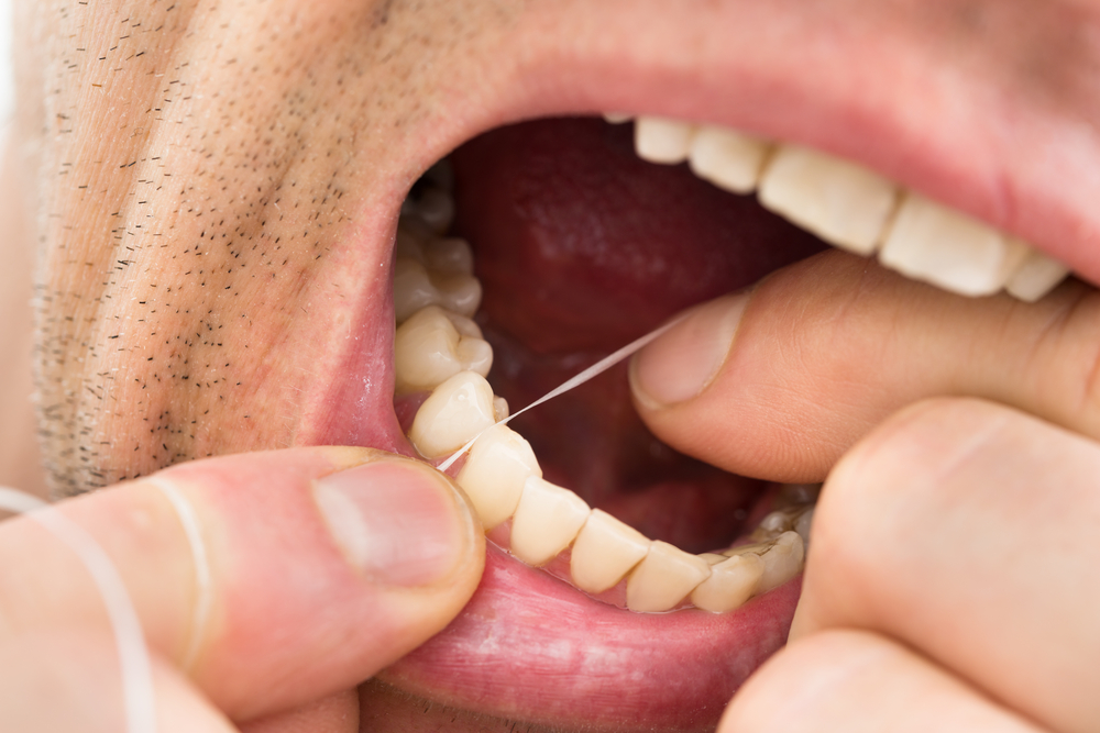 Effective Home Methods to Remove Dental Plaque