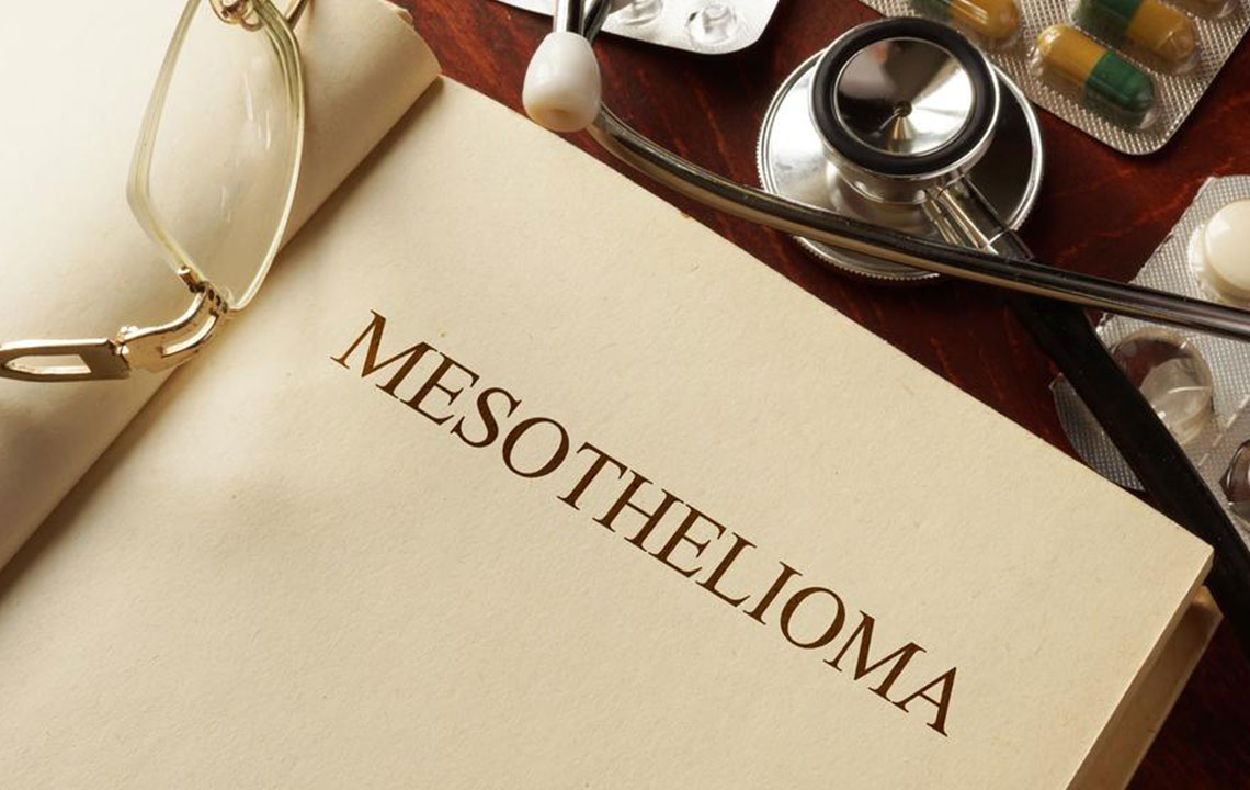 Understanding the Four Types of Mesothelioma and Their Characteristics